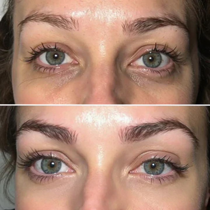 RegardLumi™ – Patchs Yeux Anti-Cernes & Lissants