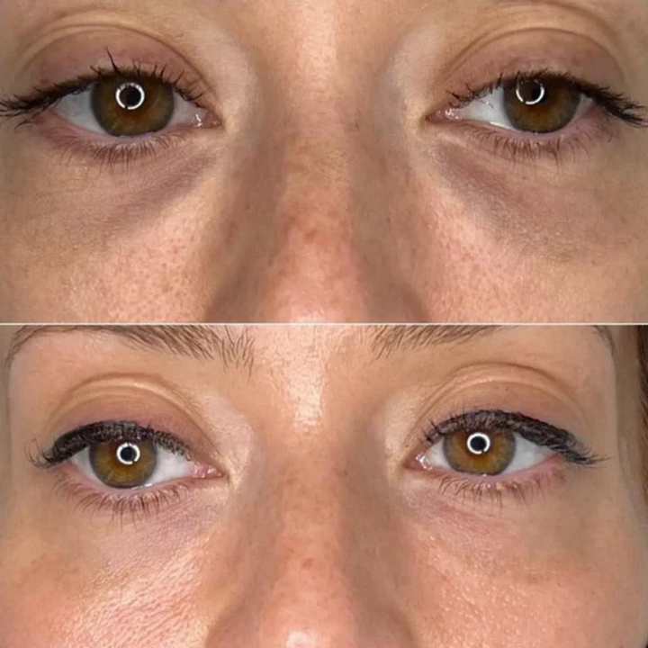 RegardLumi™ – Patchs Yeux Anti-Cernes & Lissants